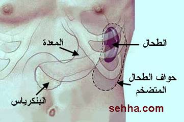 إجابة سؤال وهي عضو يخلص الجسم من الخلايا الهرمة مكونة من ست حروف ؟