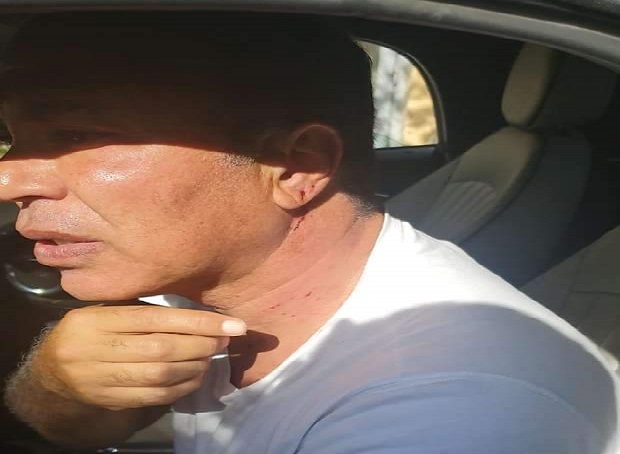 بالصور.. الاعتداء بالضرب على أيمن يونس وتحطيم سيارته