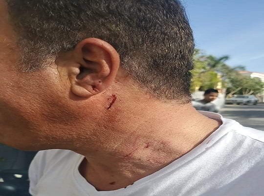 أيمن يونس يكشف تفاصيل حديثة بشأن الاعتداء عليه أمام منزله