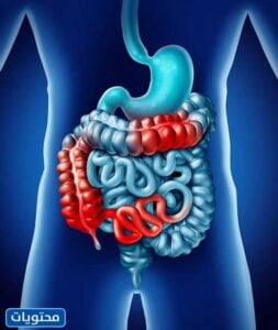 موقع متلازمة القولون العصبي